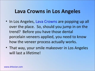 [object Object],[object Object],Lava Crowns in Los Angeles www.drkezian.com 