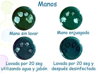 Mano sin lavar Mano enjuagada Lavada por 20 seg utilizando agua y jabón Lavada por 20 seg y después desinfectada Manos 
