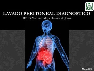 LAVADO PERITONEAL DIAGNOSTICO
      R2CG Martínez Maya Hermes de Jesús




                                           Mayo 2012
 