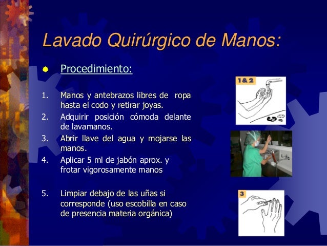 En Cuantos Tiempos Se Divide El Lavado Quirurgico