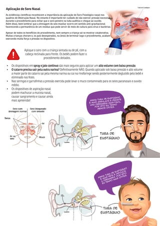 Minha Tuba de Eustáquio
é mais angulada e permite
uma drenagem mais fácil.
Por isto eu tenho
menos otites.
Minha Tuba de Eustáquio
é mais reta e dificulta
a drenagem. Por isto
eu tenho mais otites.
Tuba de
Eustáquio
Tuba de
Eustáquio
Aplicação de Soro Nasal
As evidências cientíﬁcas reconhecem a importância da aplicação do Soro Fisiológico nasal nos
quadros de Obstrução Nasal. No entanto é importante ter cuidado de não exercer pressão excessiva
durante o procedimento para evitar que o soro penetre na tuba auditiva e chegue ao ouvido.
Além disso, bom lembrar que a drenagem do seio maxilar ocorre em sentido anti-gravitacional
favorecendo a permanência de um resíduo que pode servir de meio de cultura para vírus e bactérias.
Apesar de todos os benefícios do procedimento, nem sempre a criança vai se mostrar colaborativa.
Muitas crianças choram e, os pais desesperados, na ânsia de terminar logo o procedimento, acabam
exercendo muita força e pressão no dispositivo.
Aplique o soro com a criança sentada ou de pé, com a
cabeça reclinada para frente. Os bebês podem fazer o
procedimento deitados.
• Os dispositivos em spray e jato contínuo são mais seguros para aplicar um alto volume com baixa pressão.
• O catarro precisa sair pela outra narina? Deﬁnitivamente NÃO. Quando aplicado sob baixa pressão e alto volume
a maior parte do catarro sai pela mesma narina ou cai na rinofaringe sendo posteriormente deglutido pelo bebê e
eliminado nas fezes.
• Nas seringas e garraﬁnhas a pressão exercida pode levar o muco contaminado para os seios paranasais e ouvido
médio.
• Os dispositivos de aspiração nasal
podem machucar a mucosa nasal,
causar sangramento e causar ainda
mais apreensão!
 
