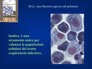 BAL: una finestra aperta sul polmone




Inoltre, è uno
strumento unico per
valutare le popolazioni
cellulari del tratto
respiratorio inferiore.
 