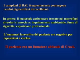 I campioni di BAL frequentemente contengono
residui pigmentiferi intracellulari.


In genere, il materiale carbonaceo trovato nei macrofagi
alveolari si associa a: inquinamento ambientale, fumo di
sigaretta, esposizione professionale.

L’anamnesi lavorativa del paziente era negativa per
esposizioni a rischio.
     .

 Il paziente era un fumatore abituale di Crack.
 