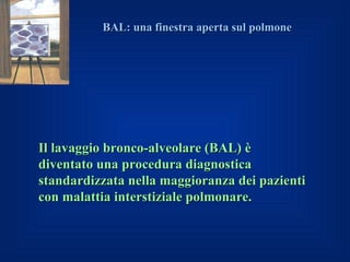 BAL: una finestra aperta sul polmone




Il lavaggio bronco-alveolare (BAL) è
diventato una procedura diagnostica
standardizzata nella maggioranza dei pazienti
con malattia interstiziale polmonare.
 