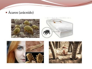  Ácaros (arácnido)
 