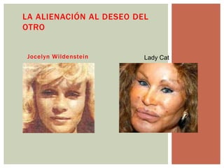 LA ALIENACIÓN AL DESEO DEL
OTRO
Jocelyn Wildenstein Lady Cat
 