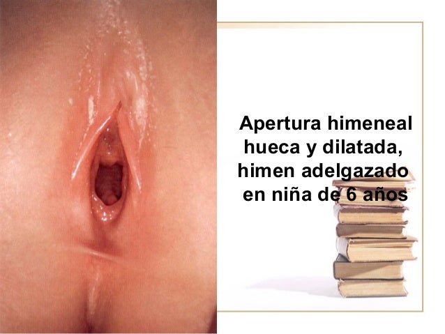 Los ejercicios para el aumento del pene leer onlayn