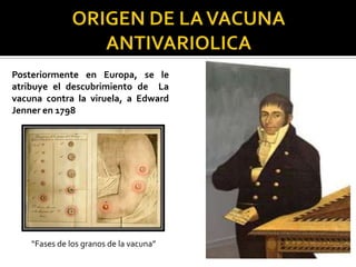 ORIGEN DE LA VACUNA ANTIVARIOLICAPosteriormente en Europa, se le atribuye el descubrimiento de  La vacuna contra la viruela, a Edward Jenner en 1798“Fases de los granos de la vacuna”