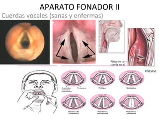 APARATO FONADOR II Cuerdas vocales (sanas y enfermas)