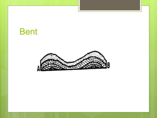 Bent
 