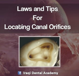 Laws and Tips for Locating Canal Orifices