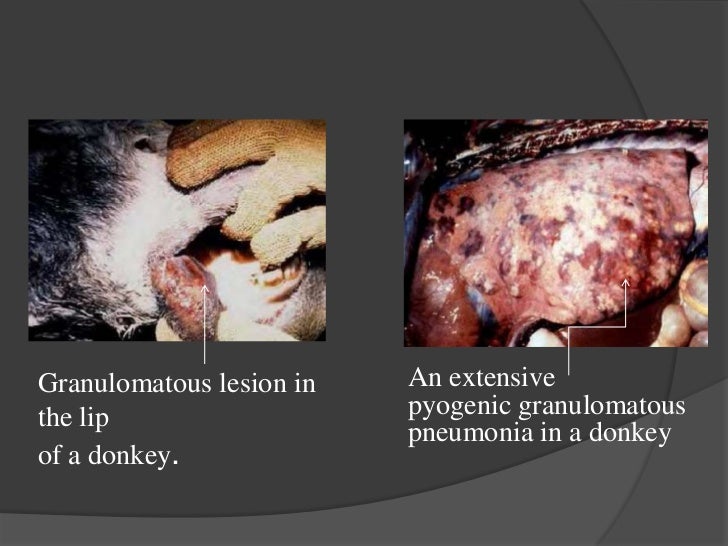 blood g test Glanders