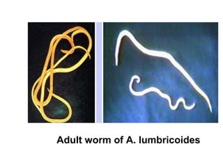 Adult worm of A. lumbricoides
 