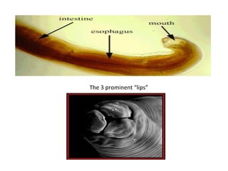 The 3 prominent “lips”
 