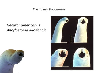 The Human Hookworms



Necator americanus
Ancylostoma duodenale
 