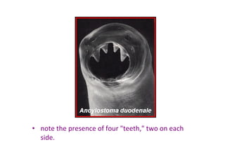 • note the presence of four "teeth," two on each 
  side. 
 