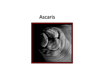 Ascaris
 