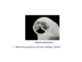 Necator americanus

• Note the presence of two cutting "teeth“.
 