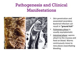 Pathogenesis and Clinical
     Manifestations
                •   Skin penetration and 
                    associated secondary 
                    bacterial infection can 
                    result in “ground itch”
                •   Pulmonary phase is 
                    usually asymptomatic
                •   Intestinal phase: worms 
                    attach to the mucosa and 
                    feed on blood. Worms 
                    continuously move to 
                    new places exacerbating 
                    bleeding
 