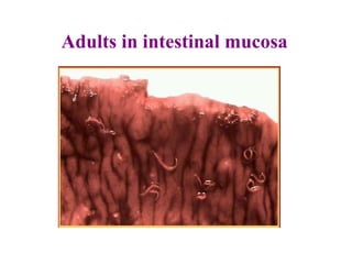 Adults in intestinal mucosa
 