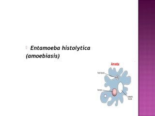  Entamoeba histolytica
(amoebiasis)
 