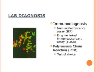 LAB DIAGNOSIS
                 Immunodiagnosis
                     Immunofluorescence
                      assay (IFA)
                     Enzyme linked
                      immunoabsorbant
                      assay (ELISA)
                   Polymerase Chain
                    Reaction (PCR)
                       Test of choice
 