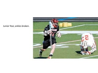 Junior Year, ankles broken.
 