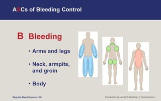 ABCs of Bleeding Control
Introduction | A-Alert | B-Bleeding | C-Compression |
Stop the Bleed Course v. 2.0
B Bleeding
• Arms and legs
• Neck, armpits,
and groin
• Body
 