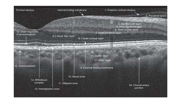 Layers of retina over OCT and histology.pptx