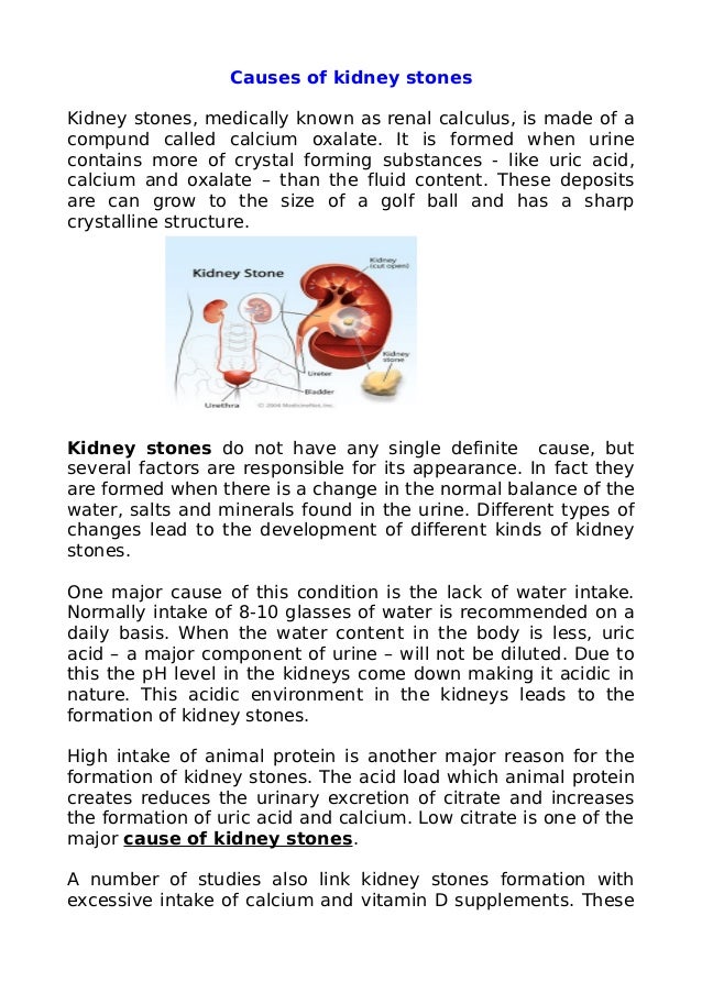 what may cause a renal calculi or kidney stones what may cause a renal calculi or kidney stones
