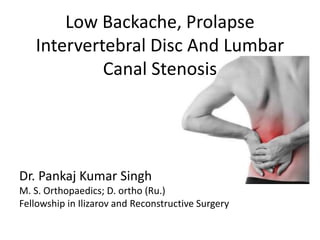 Low Backache, Prolapse
Intervertebral Disc And Lumbar
Canal Stenosis
Dr. Pankaj Kumar Singh
M. S. Orthopaedics; D. ortho (Ru.)
Fellowship in Ilizarov and Reconstructive Surgery
 