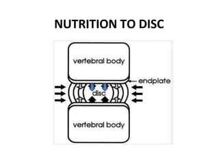 Prolapsed intervertebral disc | PPTX