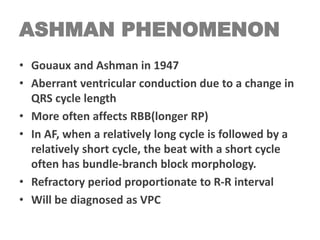 ASHMAN PHENOMENON
• Gouaux and Ashman in 1947
• Aberrant ventricular conduction due to a change in
QRS cycle length
• More often affects RBB(longer RP)
• In AF, when a relatively long cycle is followed by a
relatively short cycle, the beat with a short cycle
often has bundle-branch block morphology.
• Refractory period proportionate to R-R interval
• Will be diagnosed as VPC
 