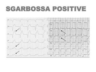 SGARBOSSA POSITIVE
 