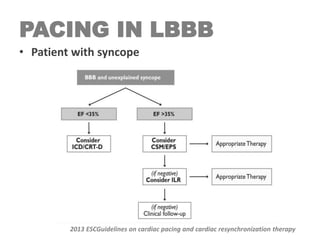 PACING IN LBBB
• Patient with syncope
2013 ESCGuidelines on cardiac pacing and cardiac resynchronization therapy
 