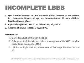 INCOMPLETE LBBB
1. QRS duration between 110 and 119 ms in adults, between 90 and 100 ms
in children 8 to 16 years of age, and between 80 and 90 ms in children
less than 8 years of age.
2. R peak time greater than 60 ms in leads V4, V5, and V6.
3. Absence of q wave in leads I, V5, and V6.
MECHANISM
1. Slowed conduction through the LBBB
2. Enlargement of the left ventricle – prolongation of the QRS complex
that mimics incomplete LBBB (
3. LBB has multiple fascicles, involvement of few major fascicles but not
all.
AHA/ACCF/HRS Recommendations for the Standardization and Interpretation of the Electrocardiogram
 