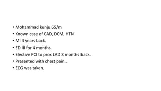 • Mohammad kunju 65/m
• Known case of CAD, DCM, HTN
• MI 4 years back.
• ED III for 4 months.
• Elective PCI to prox LAD 3 months back.
• Presented with chest pain..
• ECG was taken.
 