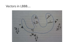 Vectors in LBBB….
 