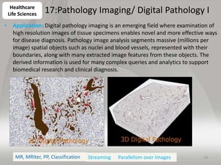 17:Pathology Imaging/ Digital Pathology II
• Current Approach: 1GB raw image data + 1.5GB analytical results per 2D image....