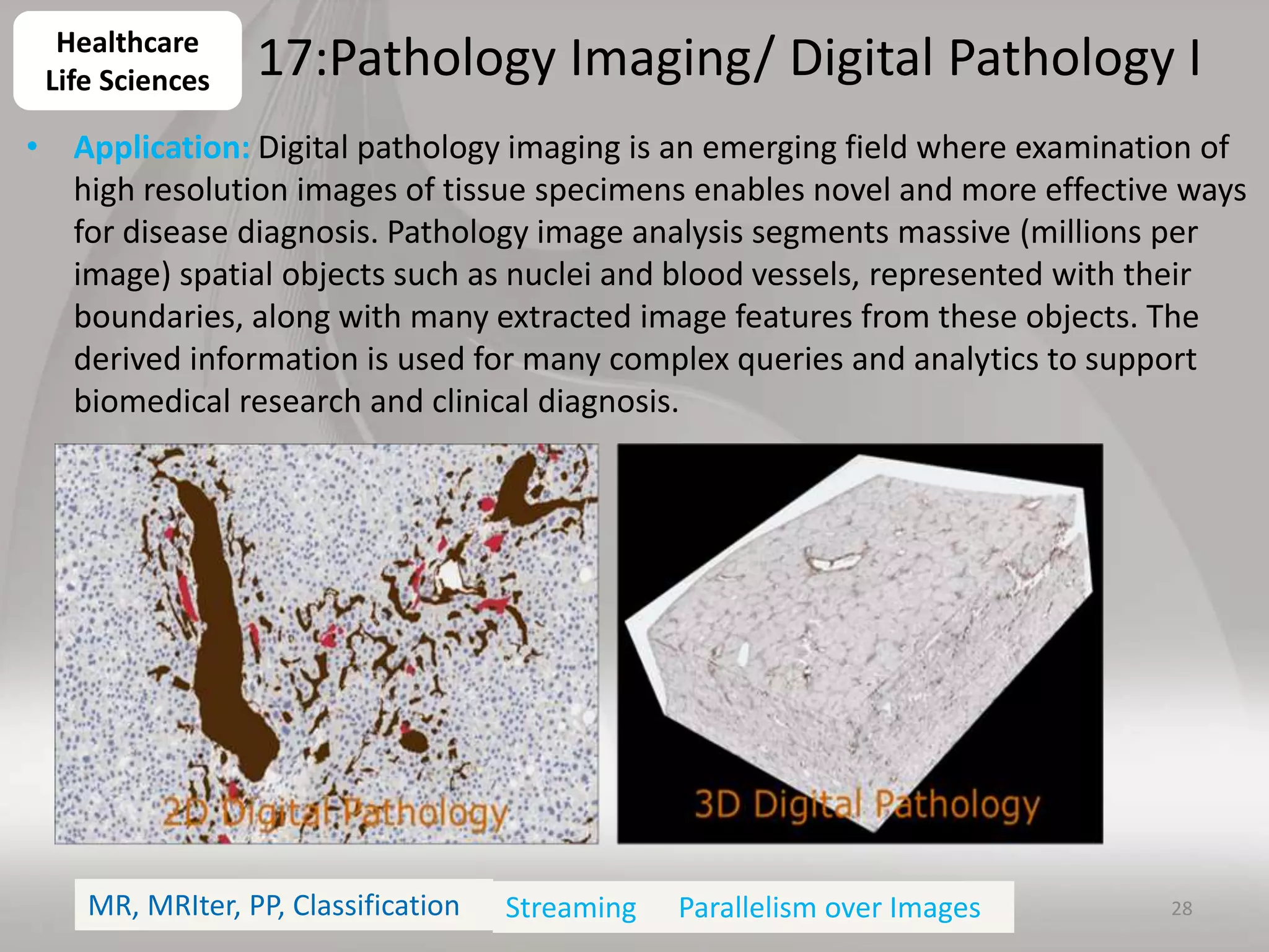 17:Pathology Imaging/ Digital Pathology I
• Application: Digital pathology imaging is an emerging field where examination of
high resolution images of tissue specimens enables novel and more effective ways
for disease diagnosis. Pathology image analysis segments massive (millions per
image) spatial objects such as nuclei and blood vessels, represented with their
boundaries, along with many extracted image features from these objects. The
derived information is used for many complex queries and analytics to support
biomedical research and clinical diagnosis.
28
Healthcare
Life Sciences
MR, MRIter, PP, Classification Parallelism over ImagesStreaming
 