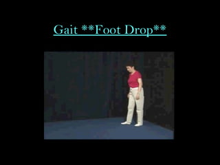 Gait **Foot Drop**
 