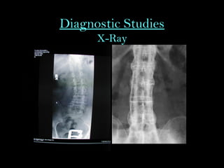 Diagnostic Studies
X-Ray
 