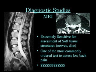 Diagnostic Studies
MRI
• Extremely Sensitive for
assessment of Soft tissue
structures (nerves, disc)
• One of the most commonly
ordered test to assess low back
pain
• $$$$$$$$$$$$$
 