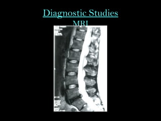 Diagnostic Studies
MRI
 