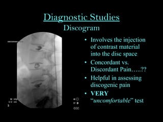 Diagnostic Studies
Discogram
• Involves the injection
of contrast material
into the disc space
• Concordant vs.
Discordant Pain…..??
• Helpful in assessing
discogenic pain
• VERY
“uncomfortable” test
 