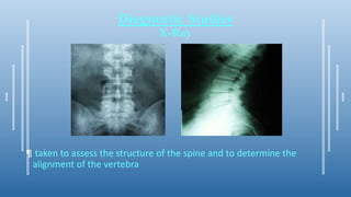 Diagnostic Studies
X-Ray
¶ taken to assess the structure of the spine and to determine the
alignment of the vertebra
 