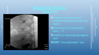 Diagnostic Studies
Discogram
¶Involves the injection of
contrast material into the disc
space
¶Concordant vs. Discordant
Pain…..??
¶Helpful in assessing discogenic
pain
¶VERY “uncomfortable” test
 
