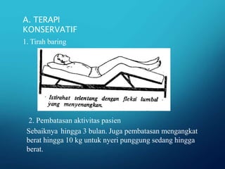 A. TERAPI
KONSERVATIF
1. Tirah baring
2. Pembatasan aktivitas pasien
Sebaiknya hingga 3 bulan. Juga pembatasan mengangkat
berat hingga 10 kg untuk nyeri punggung sedang hingga
berat.
 
