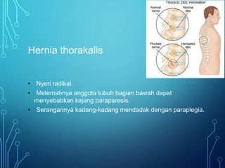 Hernia thorakalis
• Nyeri radikal.
• Melemahnya anggota tubuh bagian bawah dapat
menyebabkan kejang paraparesis.
• Serangannya kadang-kadang mendadak dengan paraplegia.
 