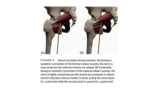 Low Back Pain.pdf